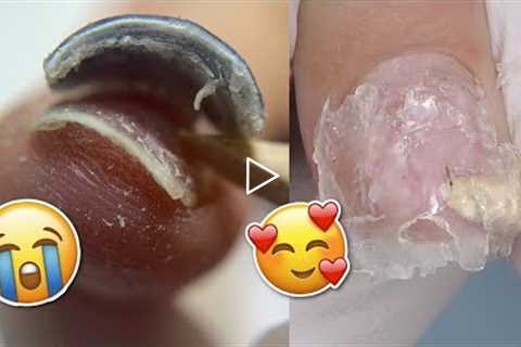 Damage FREE Soft Gel Nail Extensions Removal