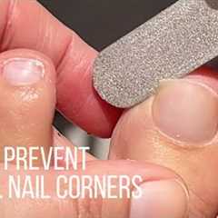 How to prevent painful nails by rounding off nail corners w/ultra thin diamond file